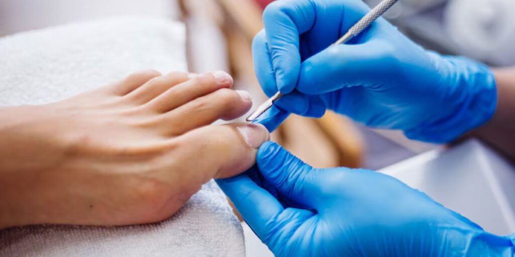 tea tree oil for nail fungus

