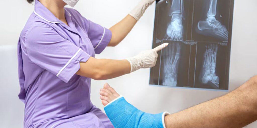 ankle fusion