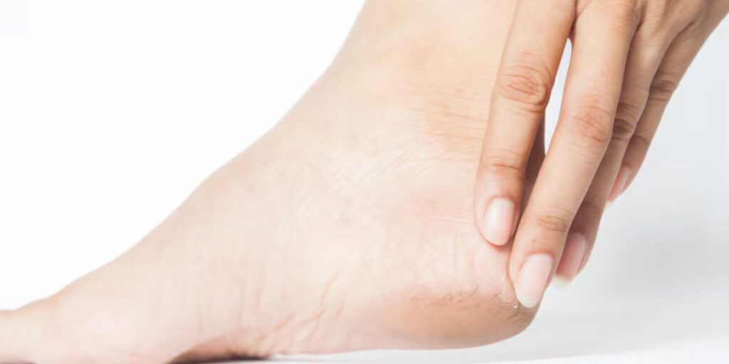 diabetic cracked feet