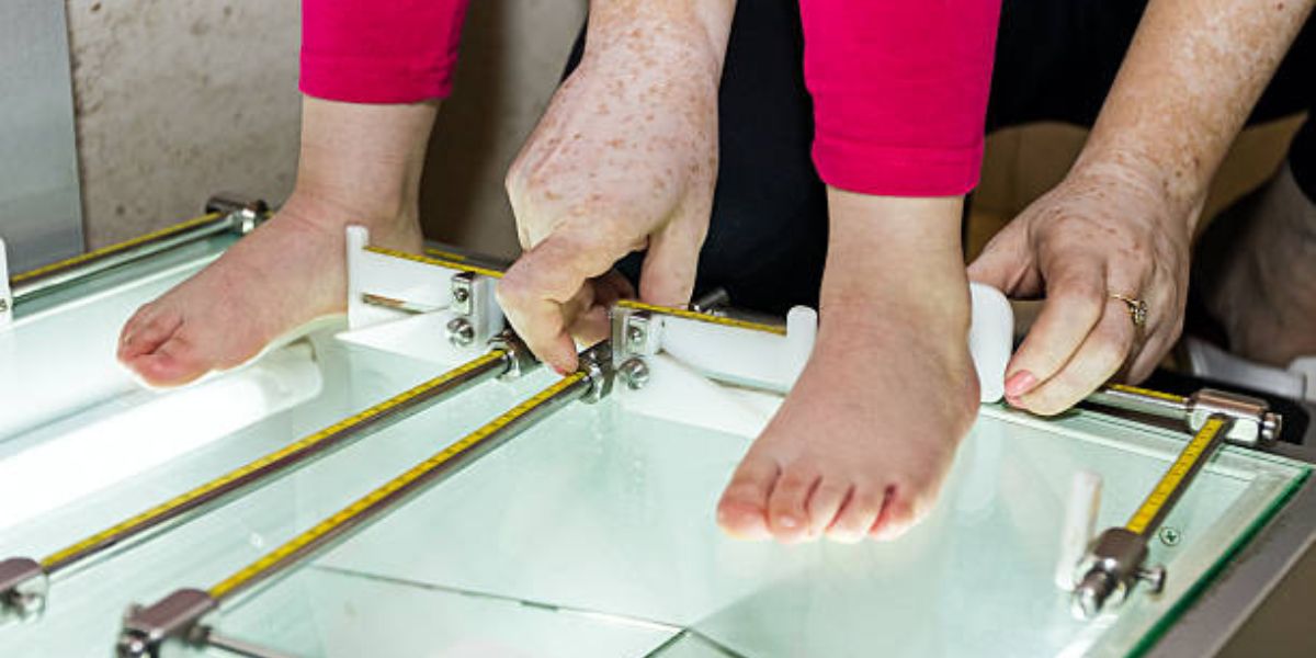 measuring foot arch height
