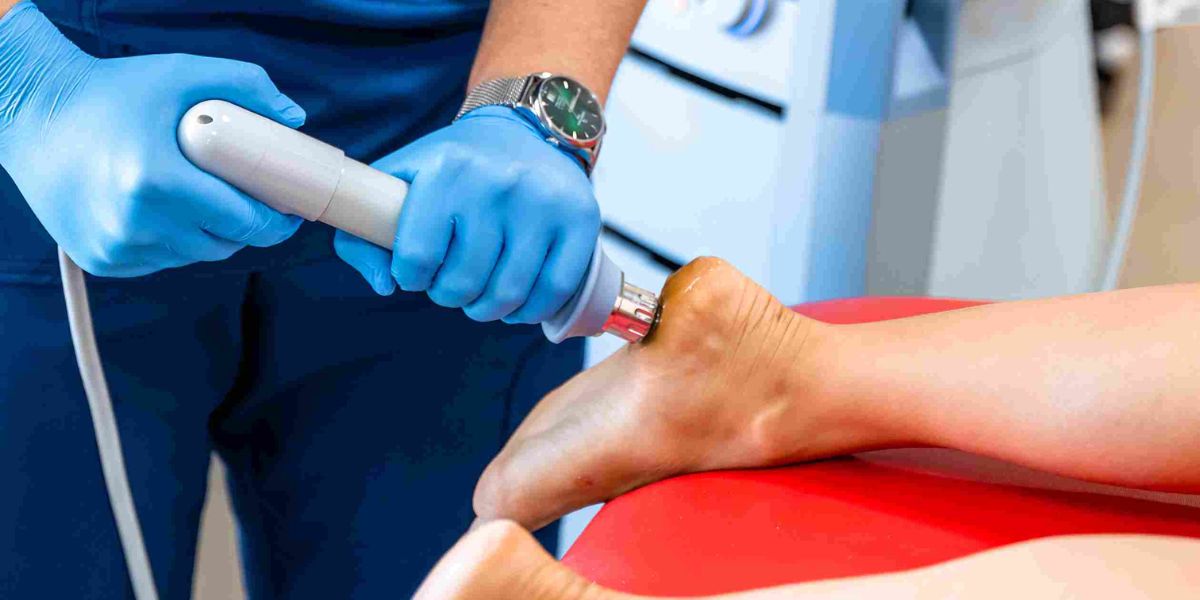 shock wave treatment for plantar fasciitis