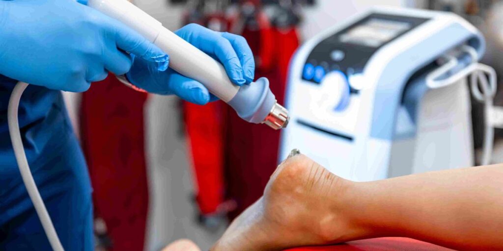 shock wave treatment for plantar fasciitis