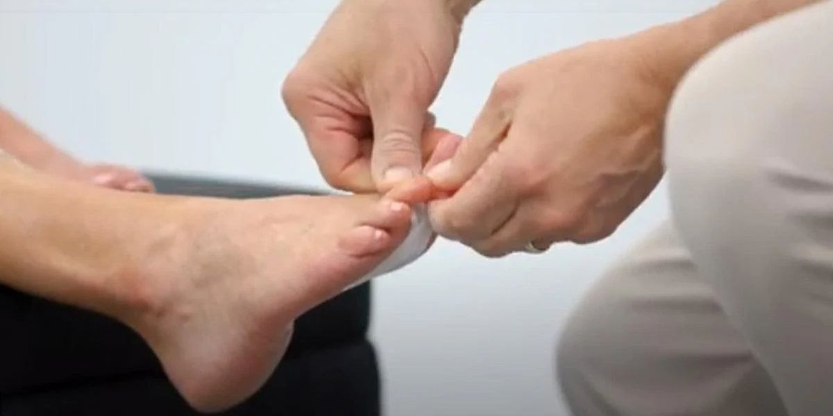 Fix Hammertoe